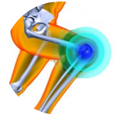 RODILLA